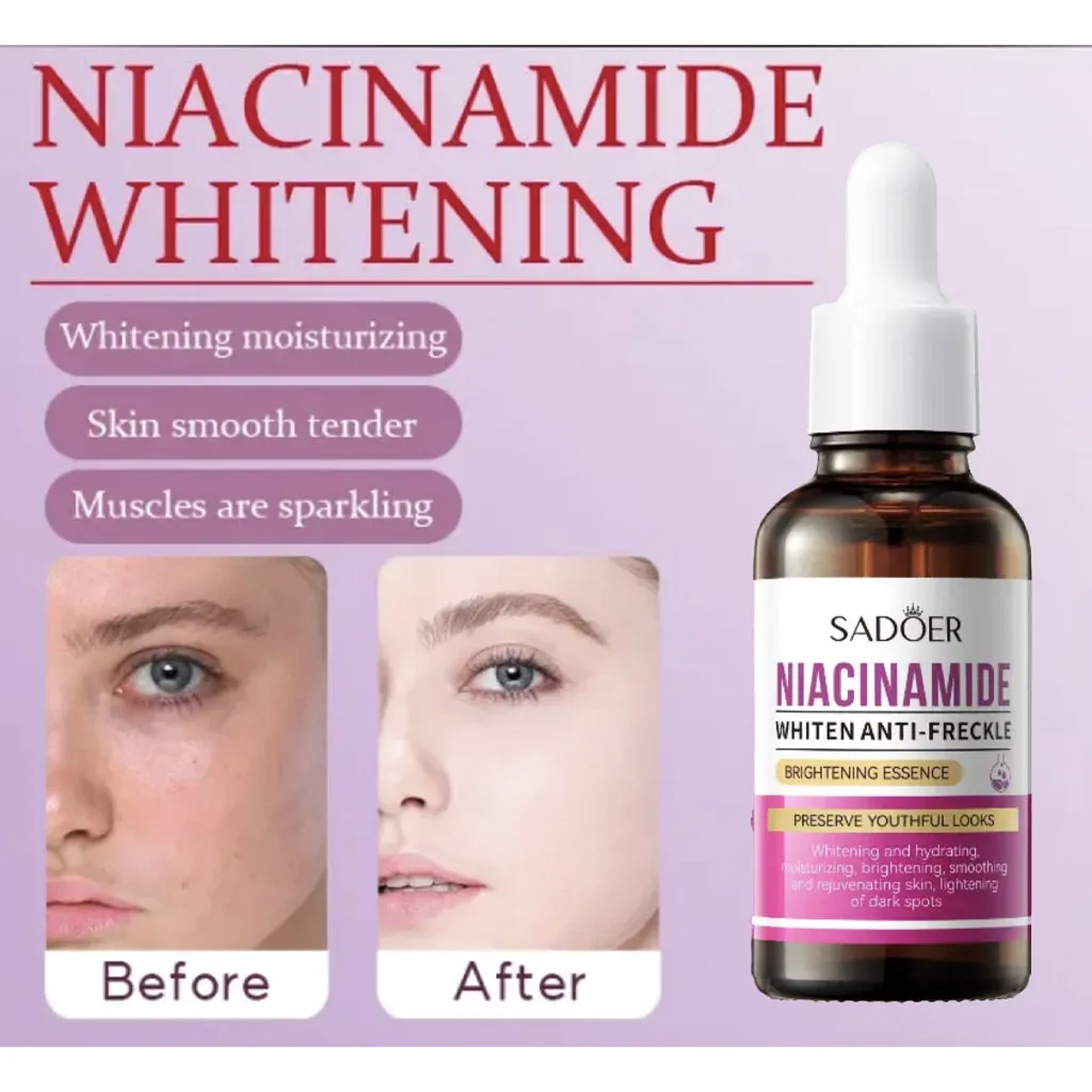 Sadoer-Niacinamide-Whiten-Anti-Freckle-Brightening-Essence-5.webp