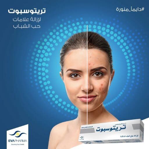 Eva Pharma Tritospot Cream (2) Eva Pharma Tritospot Cream