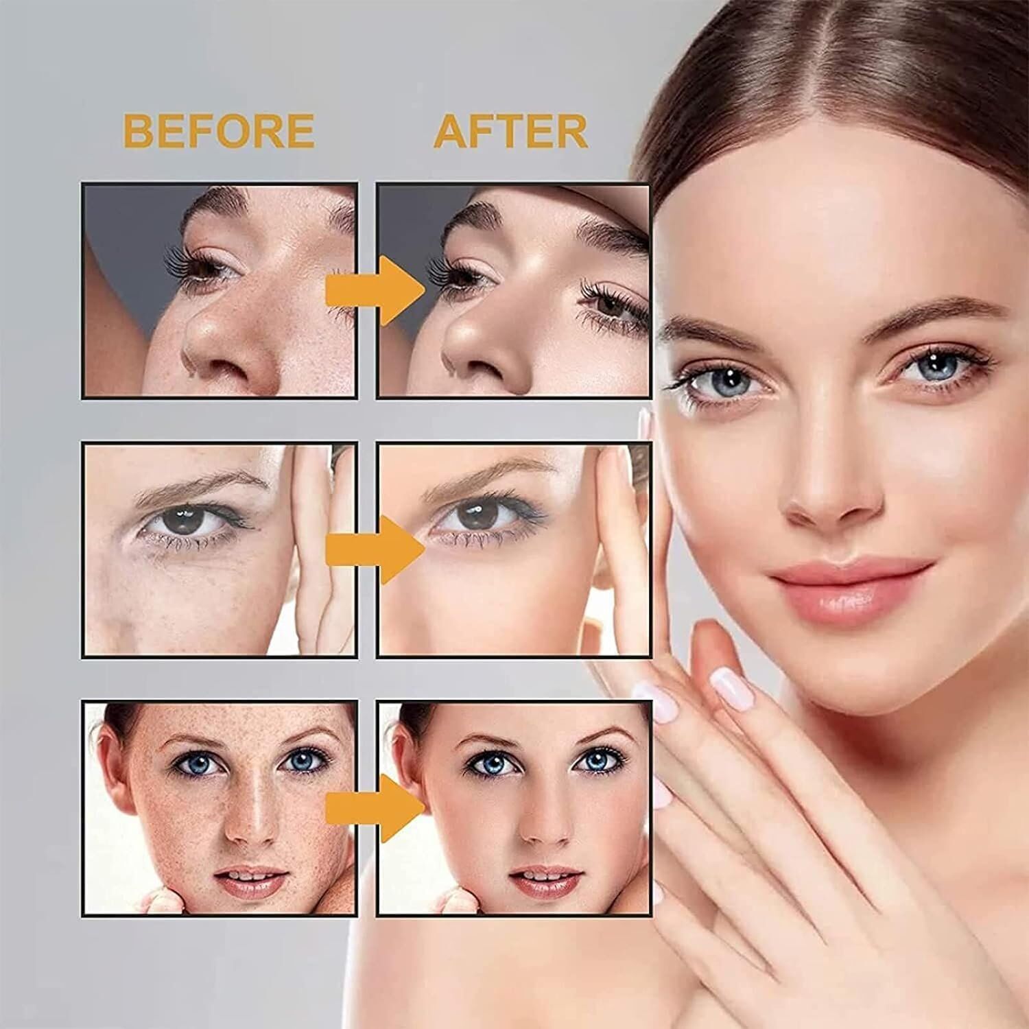 Melasma Cream (6) Dr. Hancy Japanese Melasma